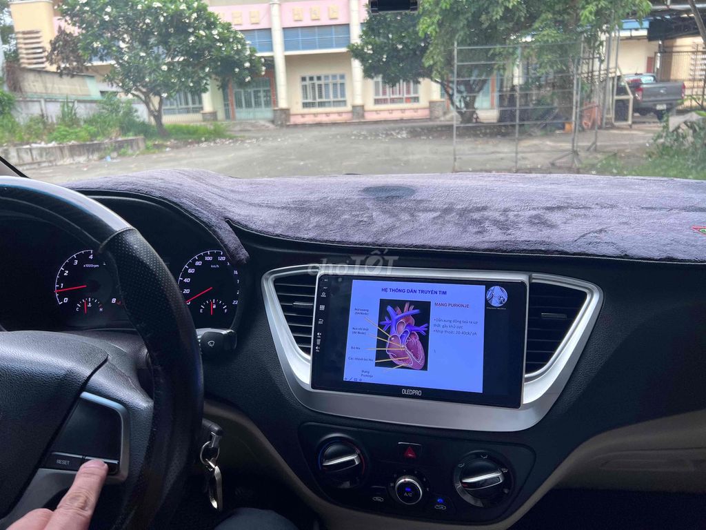 Hyundai Accent 2024 - ảnh 5